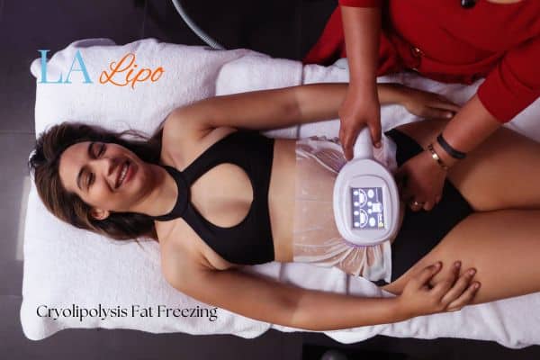 woman getting cryolipolysis Sutton on Trent