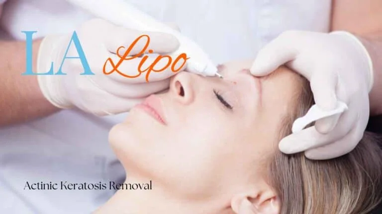 Woman receiving Actinic Keratosis Removal Treatment Sutton on Trent