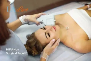 Woman having Hi-Fu to reduce wrinkles Sutton on Trent.