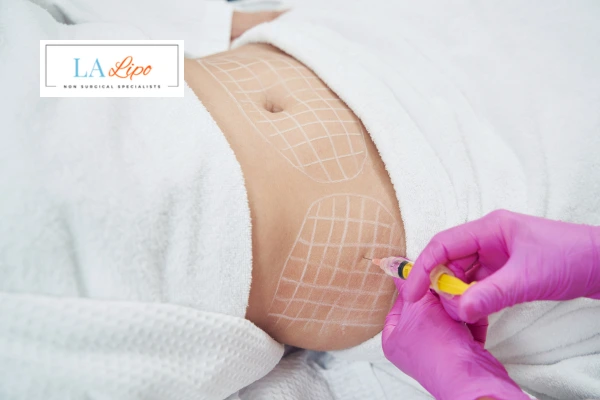 aqualyx fat dissolving injections Sutton on Trent