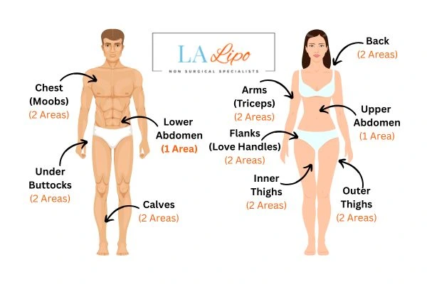 LA LIPO Cryolipolysis Areas Sutton on Trent