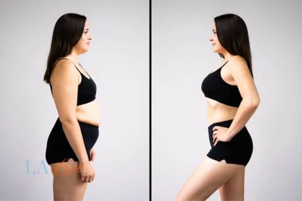 link between body image and mental health Sutton on Trent