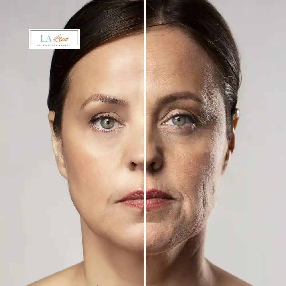 How Can You Tell If Non-Surgical Skin Tightening Is Right for You Sutton on Trent?