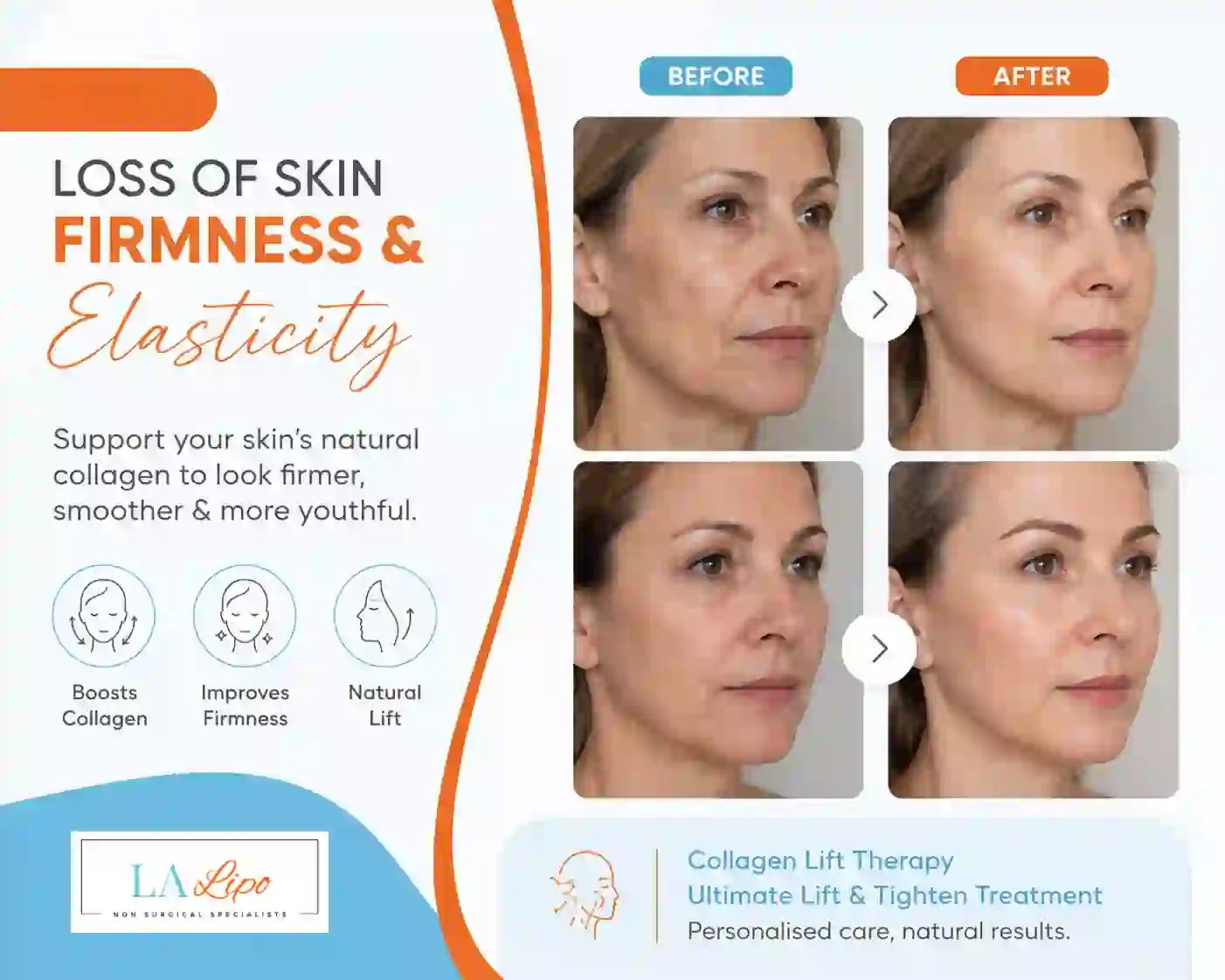 Sign #7: Loss of Skin Firmness and Elasticity Sutton on Trent